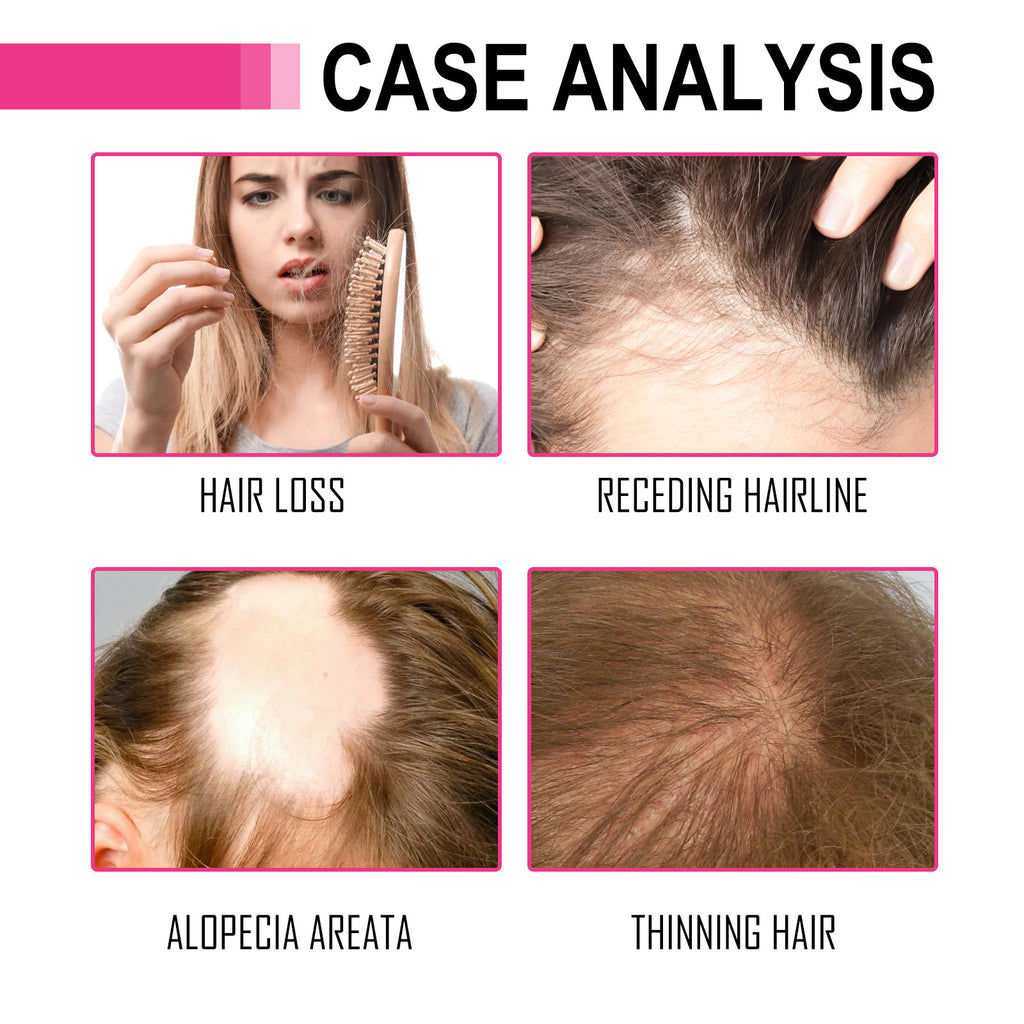 Aceite Capilar Yahfi Romero Fortalecedor y Reparador